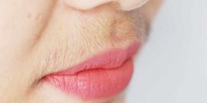 Tumbuh Kumis dan Jenggot pada Wanita, Ini Penyebabnya