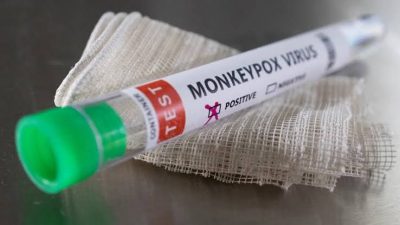 Pemerintah akan Berikan Vaksin untuk Antisipasi Penyebaran Virus Mpox , Ini Syaratnya