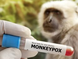 Kemenkes Ungkap Surveilans Kasus Mpox Melibatkan Kelompok Pendamping HIV