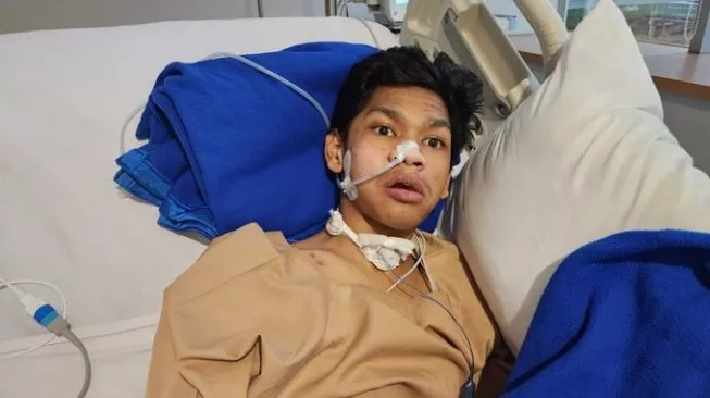 Dokter: David Ozora Alami Luka Permanen di Saraf Otak