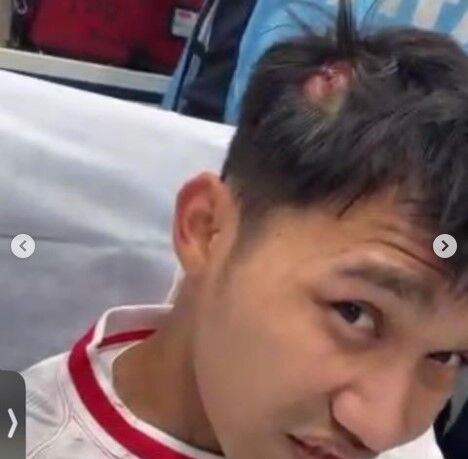 Witan Sulaiman saat lukanya mendapat perawatan