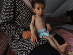 Sedikitnya 66 Anak Palestina Meninggal Akibat Malnutri Akut di Bawah Blokade Israel di Gaza
