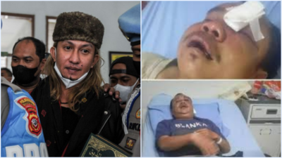 Bahar bin Smith Resmi Tersangka, Polisi Jadwalkan Pemeriksaan 4 Februari Mendatang