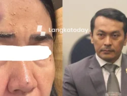 Anggota DPR Rudi Hartono Bangun Diduga Aniaya Mantan Istri, BK Diminta Turun Tangan